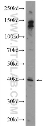 SNRNP48 Antibody in Western Blot (WB)