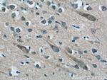 MFSD8 Antibody in Immunohistochemistry (Paraffin) (IHC (P))