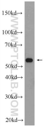 MFSD8 Antibody in Western Blot (WB)