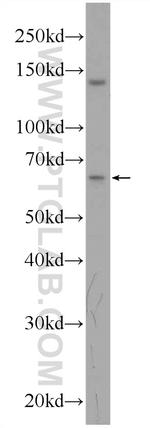 GRAMD4 Antibody in Western Blot (WB)