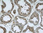 RNF17 Antibody in Immunohistochemistry (Paraffin) (IHC (P))