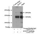 RNF17 Antibody in Immunoprecipitation (IP)