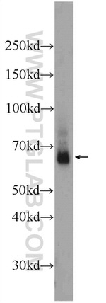 LARGE Antibody in Western Blot (WB)