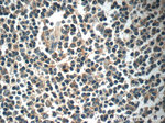 MYLK4 Antibody in Immunohistochemistry (Paraffin) (IHC (P))
