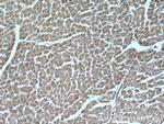 MYLK4 Antibody in Immunohistochemistry (Paraffin) (IHC (P))