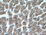 MYLK4 Antibody in Immunohistochemistry (Paraffin) (IHC (P))