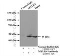 MYLK4 Antibody in Immunoprecipitation (IP)