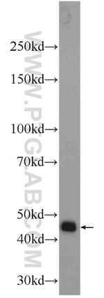 MYLK4 Antibody in Western Blot (WB)