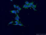 CAMK1 Antibody in Immunocytochemistry (ICC/IF)