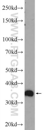 LYSMD3 Antibody in Western Blot (WB)