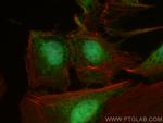 BCORL1 Antibody in Immunocytochemistry (ICC/IF)
