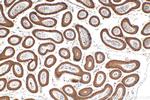 BCORL1 Antibody in Immunohistochemistry (Paraffin) (IHC (P))