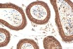 BCORL1 Antibody in Immunohistochemistry (Paraffin) (IHC (P))