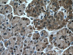 C5orf24 Antibody in Immunohistochemistry (Paraffin) (IHC (P))