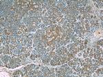 C5orf24 Antibody in Immunohistochemistry (Paraffin) (IHC (P))