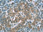 C5orf24 Antibody in Immunohistochemistry (Paraffin) (IHC (P))