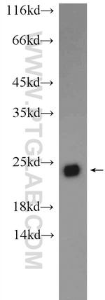 C5orf24 Antibody in Western Blot (WB)