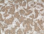 DGKB Antibody in Immunohistochemistry (Paraffin) (IHC (P))