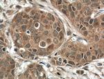 DGKB Antibody in Immunohistochemistry (Paraffin) (IHC (P))