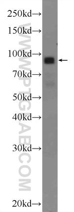 DGKB Antibody in Western Blot (WB)