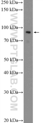 ABTB2 Antibody in Western Blot (WB)
