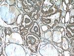 Sodium Iodide Symporter Antibody in Immunohistochemistry (Paraffin) (IHC (P))
