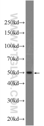 Sodium Iodide Symporter Antibody in Western Blot (WB)