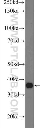 ACPT Antibody in Western Blot (WB)