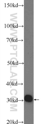 ACPT Antibody in Western Blot (WB)