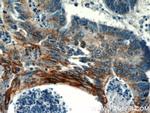 TMEM9B Antibody in Immunohistochemistry (Paraffin) (IHC (P))