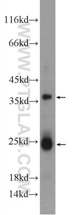 TMEM9B Antibody in Western Blot (WB)