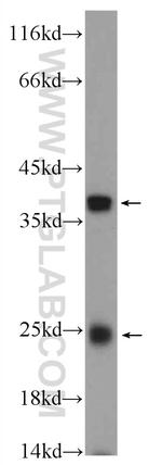 TMEM9B Antibody in Western Blot (WB)