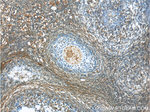 ANKRD6 Antibody in Immunohistochemistry (Paraffin) (IHC (P))