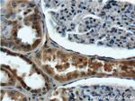 ANKRD6 Antibody in Immunohistochemistry (Paraffin) (IHC (P))