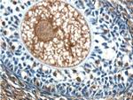 ANKRD6 Antibody in Immunohistochemistry (Paraffin) (IHC (P))