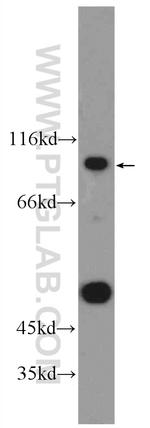 ANKRD6 Antibody in Western Blot (WB)