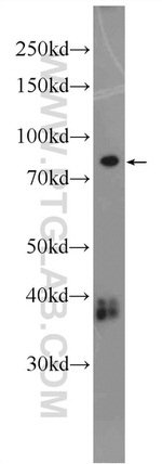 ANKRD6 Antibody in Western Blot (WB)