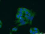 ANKRD16 Antibody in Immunocytochemistry (ICC/IF)