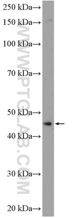 ANKRD16 Antibody in Western Blot (WB)