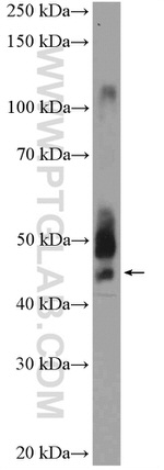 ANKRD16 Antibody in Western Blot (WB)