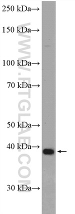 ANKRD16 Antibody in Western Blot (WB)