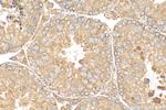BBOF1 Antibody in Immunohistochemistry (Paraffin) (IHC (P))