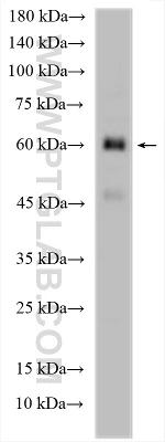 BBOF1 Antibody in Western Blot (WB)