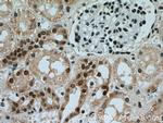 AQR Antibody in Immunohistochemistry (Paraffin) (IHC (P))