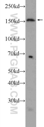 AQR Antibody in Western Blot (WB)