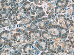 ERP29 Antibody in Immunohistochemistry (Paraffin) (IHC (P))