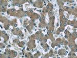 ERP29 Antibody in Immunohistochemistry (Paraffin) (IHC (P))
