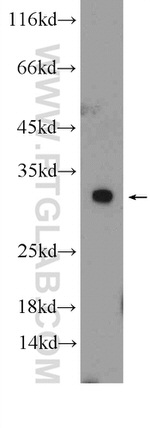 ERP29 Antibody in Western Blot (WB)