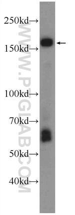 ABCA8 Antibody in Western Blot (WB)