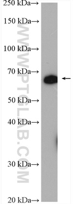 C7orf31 Antibody in Western Blot (WB)